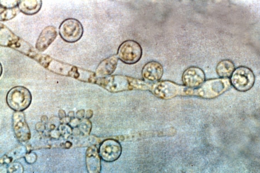 грибок кандида крузеи под микроскопом