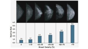 mammogram