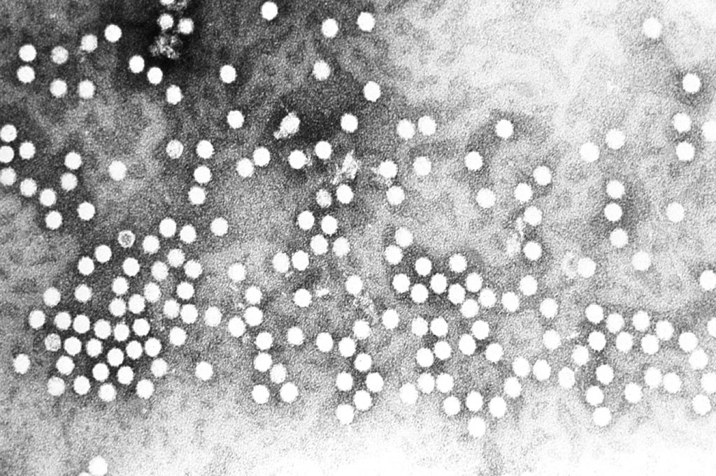 Parvovirus h 1 virions of the parvoviridae family of dna viruses